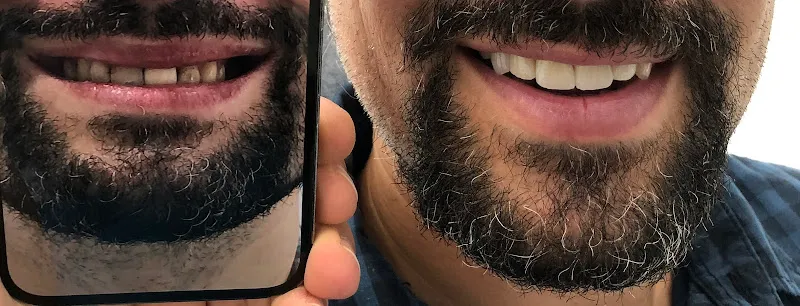 Harun Yıldırım Dental Clinic Kyrenia Cyprus