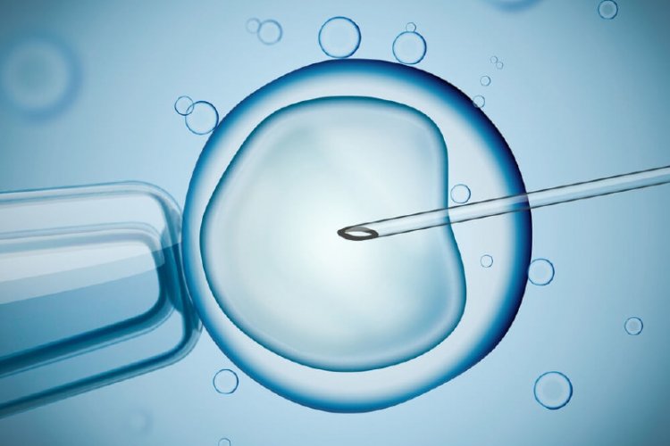Cyprus IVF Center - Kıbrıs Tüpbebek Merkezi