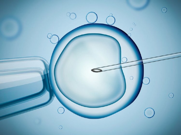 Cyprus IVF Center - Kıbrıs Tüpbebek Merkezi